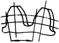 �X݆�����g(sh��)�Z�A���X݆�͈A���X݆��